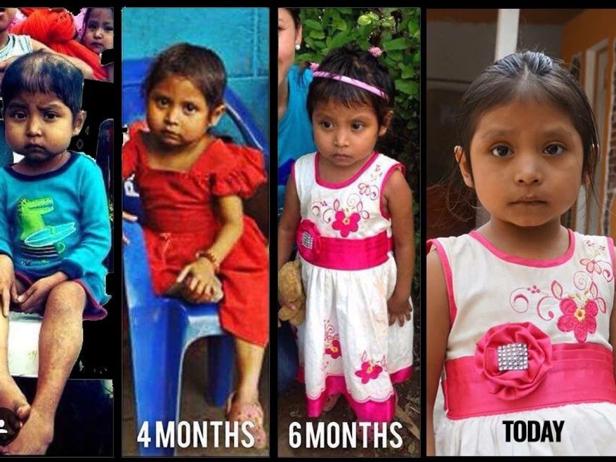 Inspira Guate: Ingrid’s Journey to Health and Hope